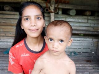 Tidak Mempunyai BPJS dan KIS, Penderita Perut Membesar Ini Tidak Bisa Berobat